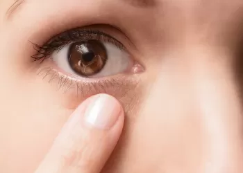 Göz Lensi ile İlgili Tüm Merak Edilenler